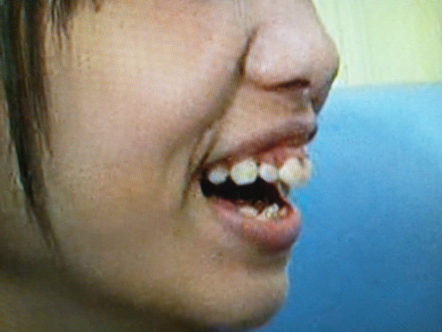 岡本尚子の歯茎