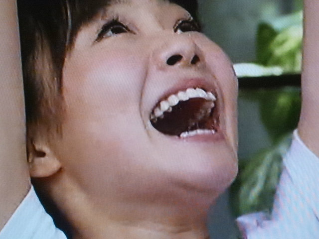 Hkt48の穴井千尋さんの前歯の画像 僕の審美歯科ガイド 前歯の差し歯治療で後悔しないための情報源