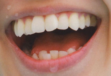 大島優子　前歯の写真