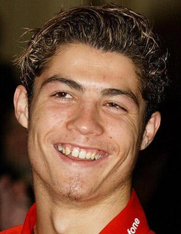 Cristiano Ronaldo　前歯