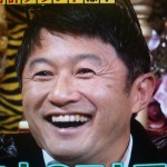 武田修宏さんの前歯の画像（虫歯）