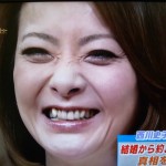 西川史子さんの前歯や歯並びを批評（八重歯）
