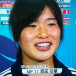 西田明華選手の前歯の画像（歯列矯正中）