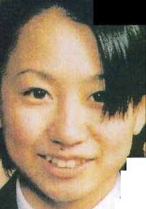 倖田來未さんの前歯の画像 僕の審美歯科ガイド 前歯の差し歯治療で後悔しないための情報源