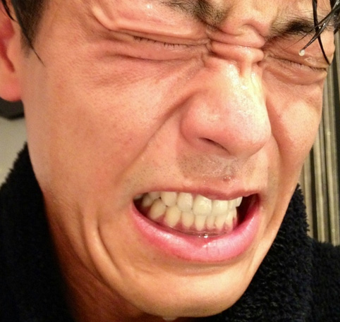 永井大さんの前歯の画像 人工歯 僕の審美歯科ガイド 前歯の差し歯治療で後悔しないための情報源