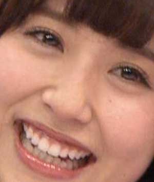 衛藤美彩 前歯の写真