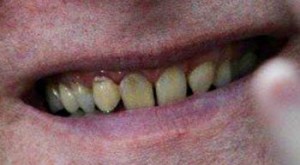 ポール・アレン氏のAppleに対する訴訟、具体性の欠如で挫折に直面