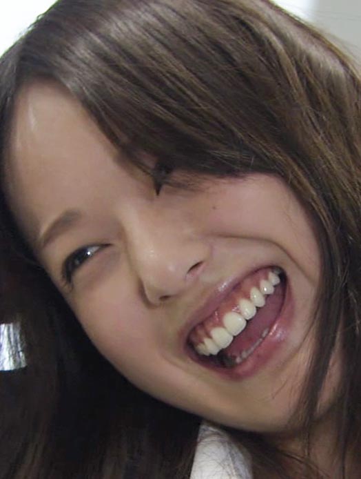 戸田恵梨香さんの前歯と歯茎を評論 歯茎整形 僕の審美歯科ガイド 前歯の差し歯治療で後悔しないための情報源