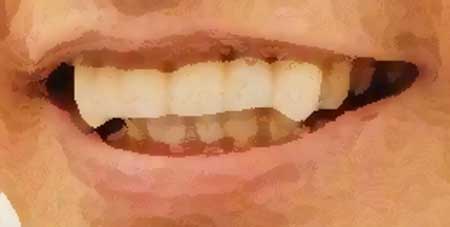 横尾渉　前歯のイラスト