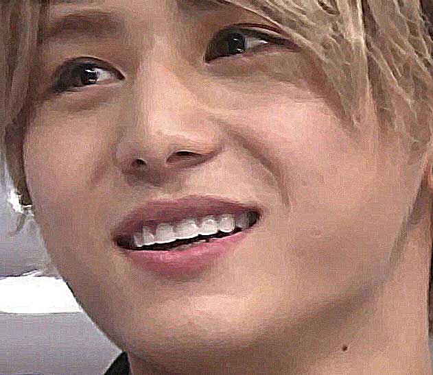 山田涼介 前歯