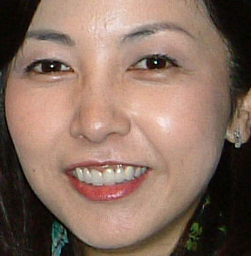 麻木久仁子の前歯の写真
