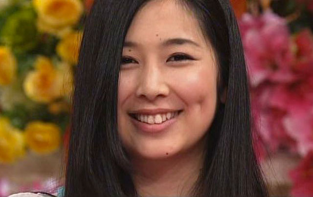 柴田美咲さんの前歯の画像 僕の審美歯科ガイド 前歯の差し歯治療で後悔しないための情報源