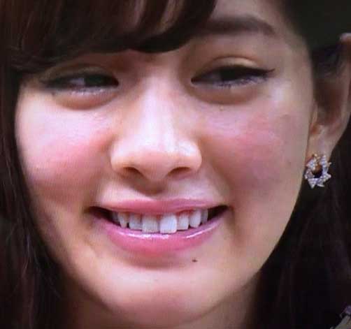 岡本杏理 前歯
