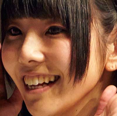 相沢梨紗　前歯の写真
