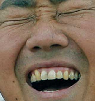 松坂大輔　前歯の写真
