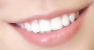 May J　前歯の写真