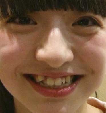 佐藤七海 前歯の写真