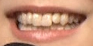 大原櫻子　前歯の写真