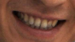 谷原章介　前歯の写真