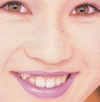 山瀬まみ 八重歯