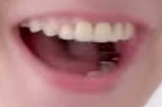 新木優子　前歯の写真