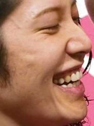 Miyaviさんの前歯や歯並び 差し歯 僕の審美歯科ガイド 前歯の差し歯治療で後悔しないための情報源