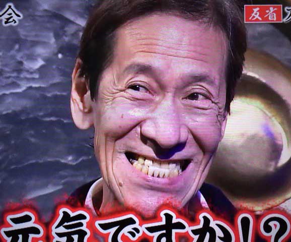 斉藤洋介さんの前歯や歯並び 変色 下顎前突 反対咬合 僕の審美歯科ガイド 前歯の差し歯治療で後悔しないための情報源