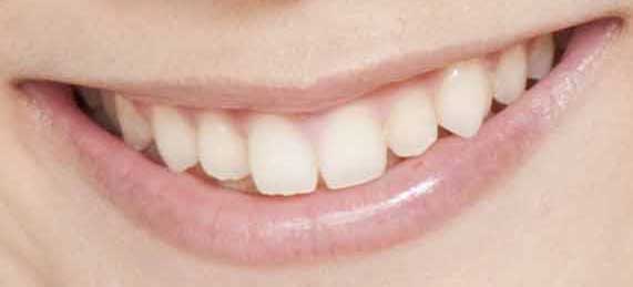津田美波　前歯の写真