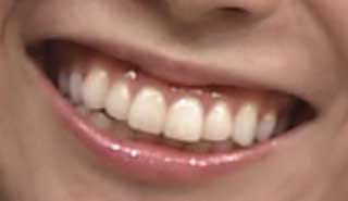 杉野真実アナ　前歯の写真