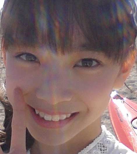 後藤萌咲 前歯の写真