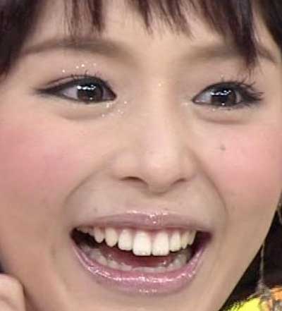 平野綾　前歯の写真