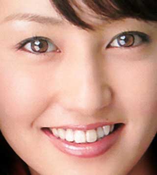 矢田亜希子　現在の前歯の写真