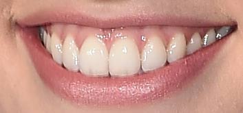 daisy ridley teeth