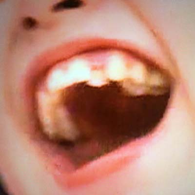 秋元結季　歯並び
