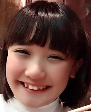 秋元結季　八重歯