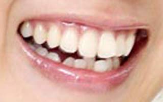 上田まりえ　歯並びの写真