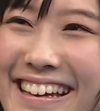 矢倉楓子　前歯の写真
