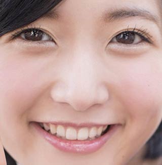 須藤凜々花　歯