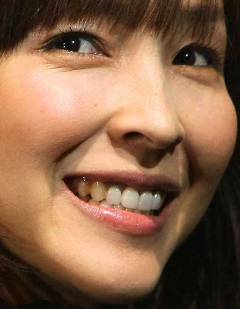 麻生久美子さんの前歯や歯並びを批評 差し歯 僕の審美歯科ガイド 前歯の差し歯治療で後悔しないための情報源